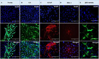 A Robust Model System for Retinal Hypoxia: Live Imaging of Calcium Dynamics and Gene Expression Studies in Primary Human Mixed Retinal Culture